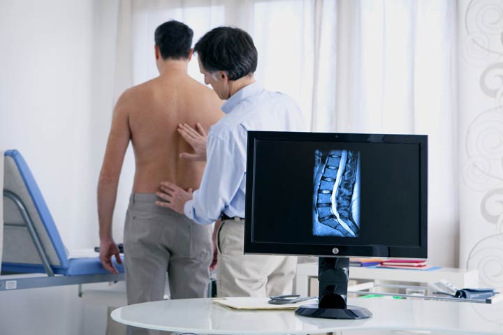 Diagnose Bandscheibenvorfall