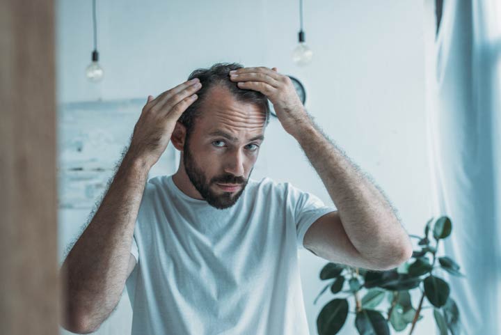 Haarausfall ist stets permanent