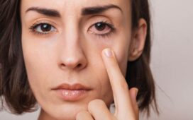 Gereizte Augen auf natürliche Weise beruhigen