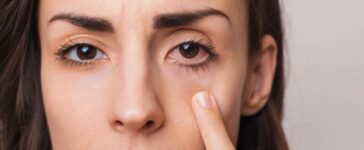 Gereizte Augen auf natürliche Weise beruhigen